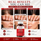 Biotin for Hair Growth Women & Men | Hair, Skin & Nails Vitamins with Collagen, Keratin and amino acids | 90 Capsules
